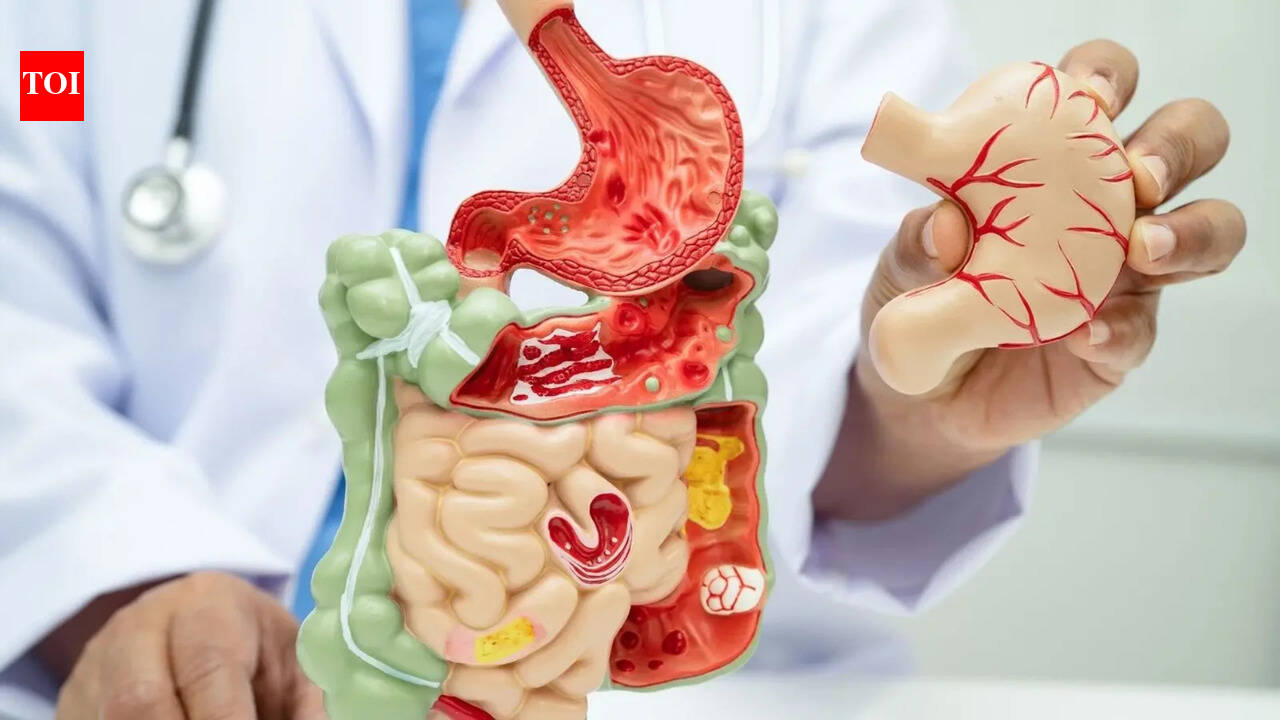Autoimmune Diseases May Start in the Gut: Early Warning Signs